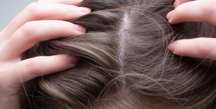 Triphasic Furterer, des soins d'excellence contre la chute de cheveux